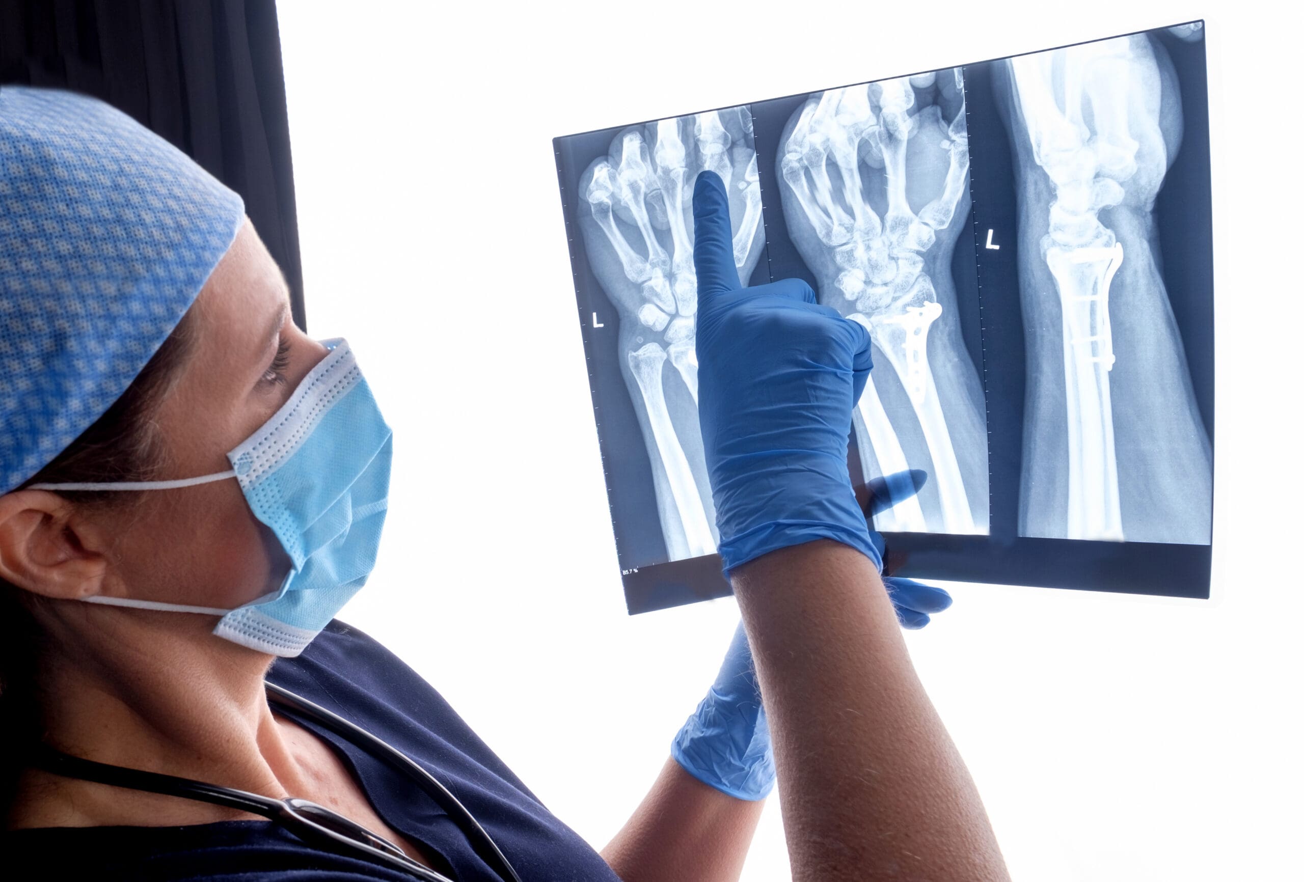 Fracture Risk Scale Manual